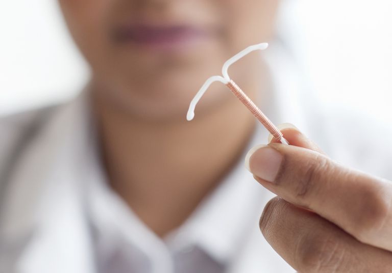 IUD removal